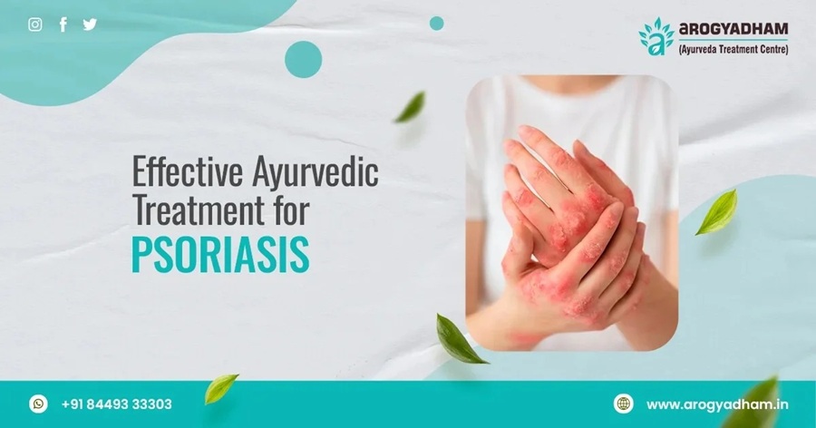ayurvedic-treatment-for-psoriasis-in-india